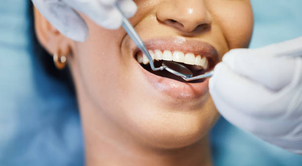 Best Emergency Wisdom Teeth Removal in Peralta, NM